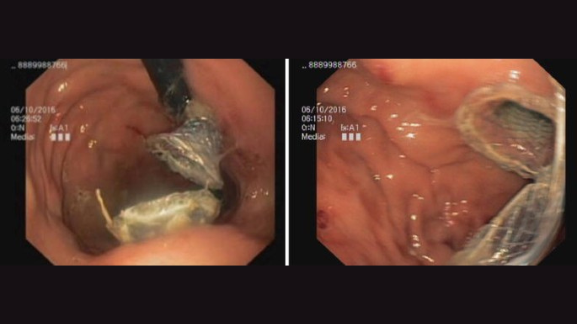 Physiotherapy & Rehabilitation